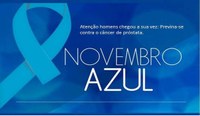 Novembro Azul: Projeto de lei visa instituir direito a folga para realização de exame de prevenção contra o Câncer de Próstata